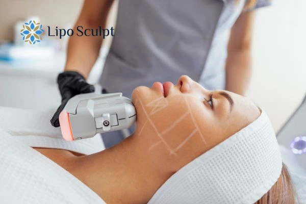 HIFU vs Botulinum Toxin: Understanding the Differences 1 HIFU vs Botox Welford on Avon What is the best option for you?