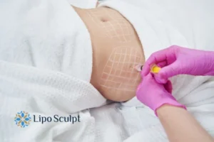 Are The Results From Aqualyx Permanent? 1 Do you want to know how long Aqualyx Welford on Avon results last?