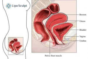 How EM Chair treatment Welford on Avon can help Leaky bladder issues. Read more now!