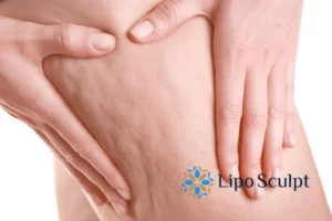 Start your journey today book your coolsculpting treatment Welford on Avon online today!