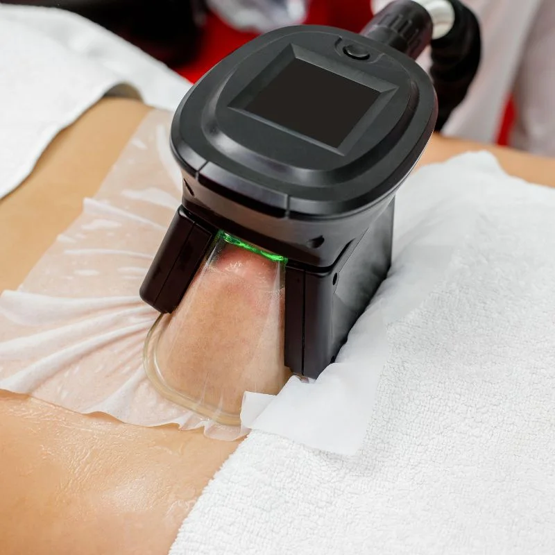 Fat Freezing treatment Welford on Avon