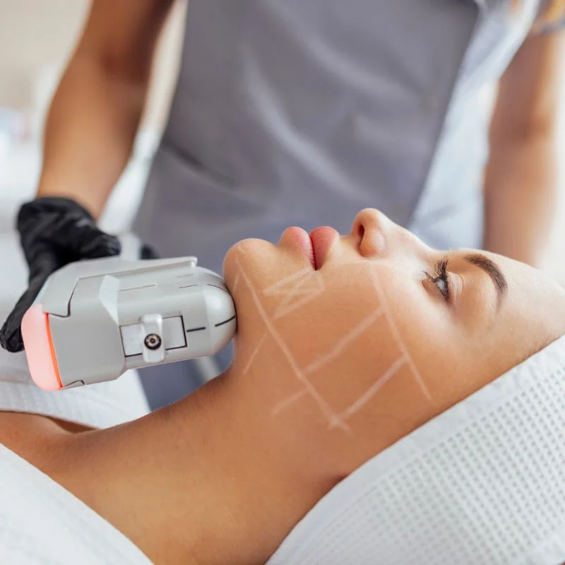HIFU non surgical treatment Welford on Avon